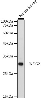 INSIG2 Antibody in Western Blot (WB)