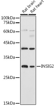INSIG2 Antibody in Western Blot (WB)
