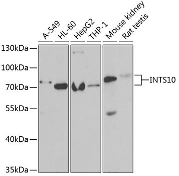 INTS10 Antibody in Western Blot (WB)