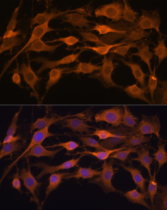 JAK1 Antibody in Immunocytochemistry (ICC/IF)