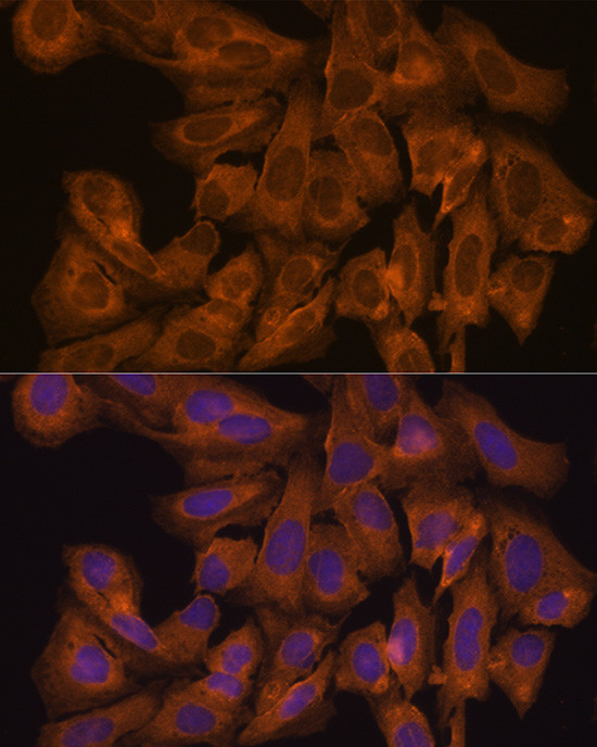 JAK1 Antibody in Immunocytochemistry (ICC/IF)