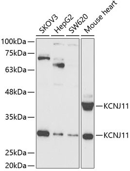 Kir6.2 (KCNJ11) Antibody in Western Blot (WB)