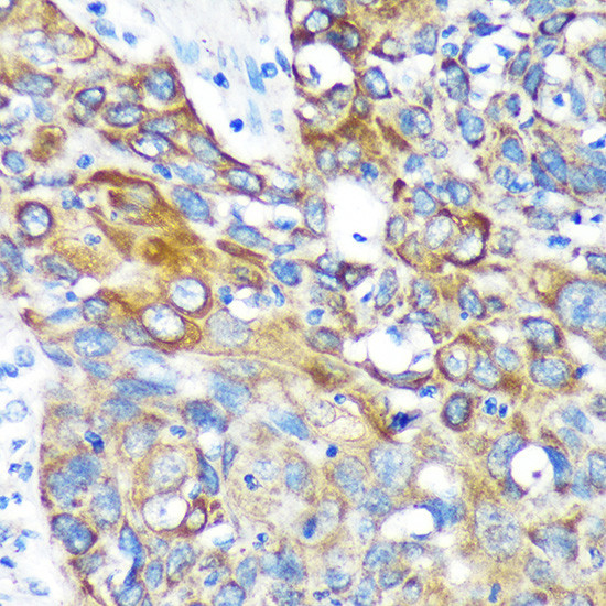 KIF17 Antibody in Immunohistochemistry (Paraffin) (IHC (P))