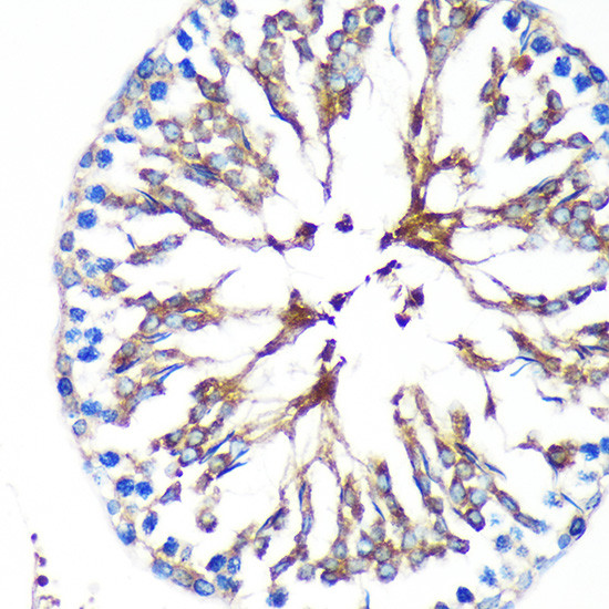 KIF17 Antibody in Immunohistochemistry (Paraffin) (IHC (P))