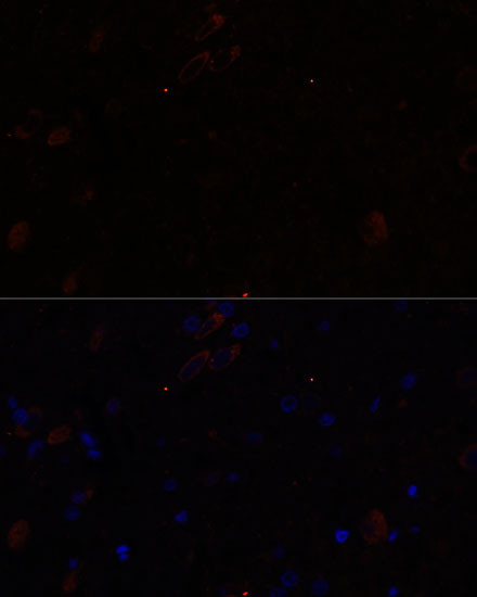 KIF17 Antibody in Immunohistochemistry (Paraffin) (IHC (P))