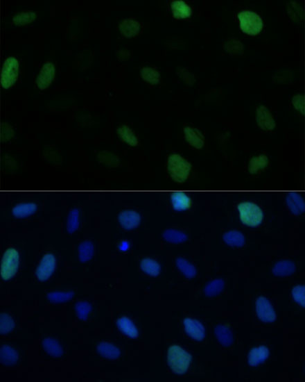 KIFC1 Antibody in Immunocytochemistry (ICC/IF)