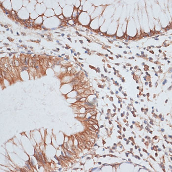 KIFC1 Antibody in Immunohistochemistry (Paraffin) (IHC (P))