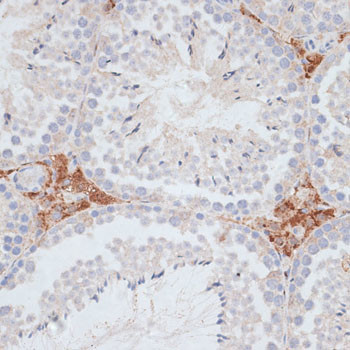 KIFC1 Antibody in Immunohistochemistry (Paraffin) (IHC (P))