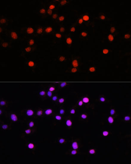 KLF8 Antibody in Immunocytochemistry (ICC/IF)