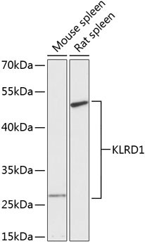 CD94 Antibody in Western Blot (WB)