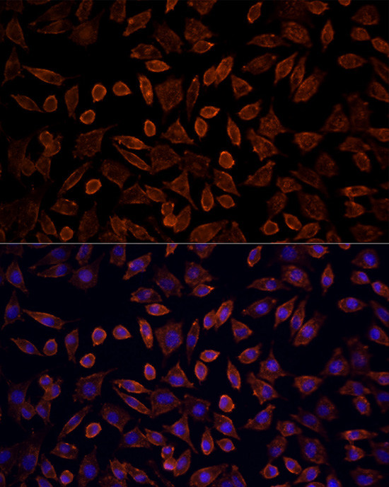 K-Ras Antibody in Immunocytochemistry (ICC/IF)