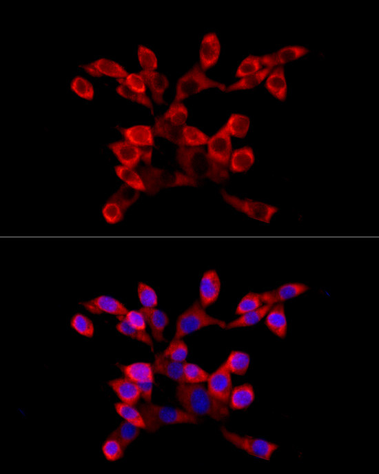 LARP4 Antibody in Immunocytochemistry (ICC/IF)