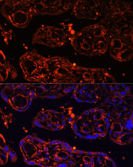 LGR4 Antibody in Immunohistochemistry (Paraffin) (IHC (P))