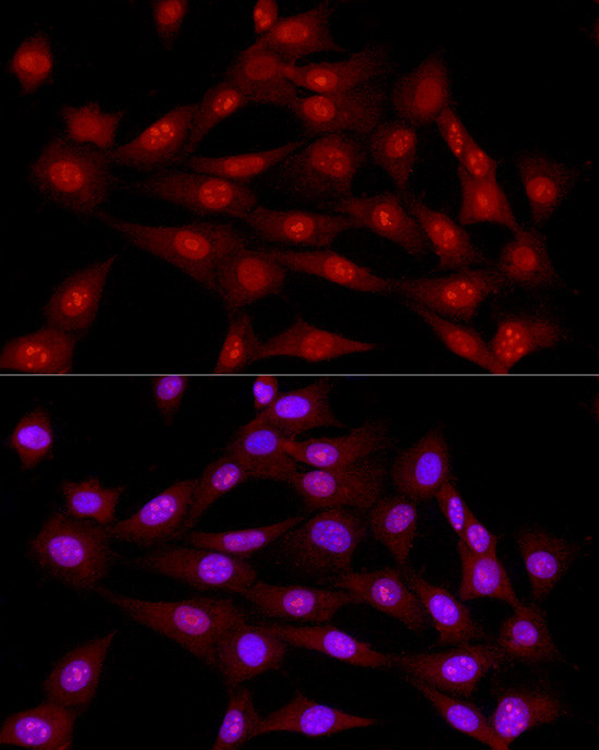 LIG3 Antibody in Immunocytochemistry (ICC/IF)