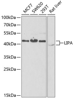 LIPA Antibody in Western Blot (WB)