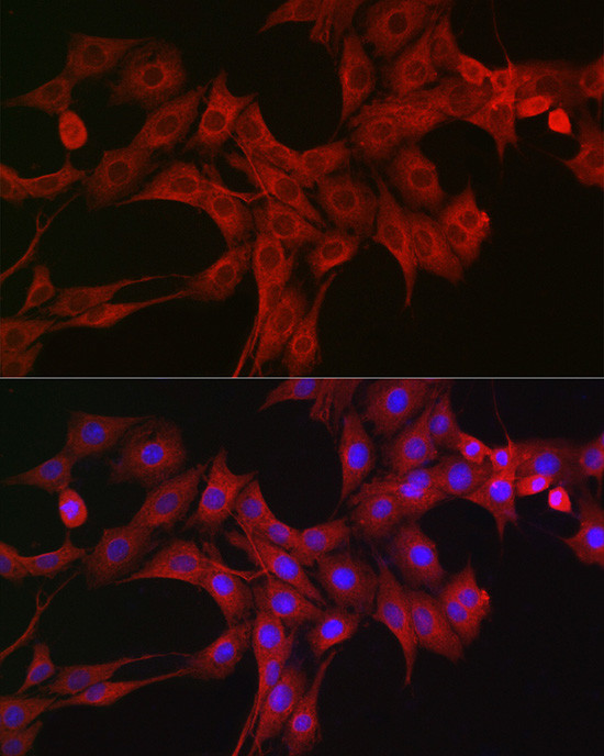 LTBR Antibody in Immunocytochemistry (ICC/IF)