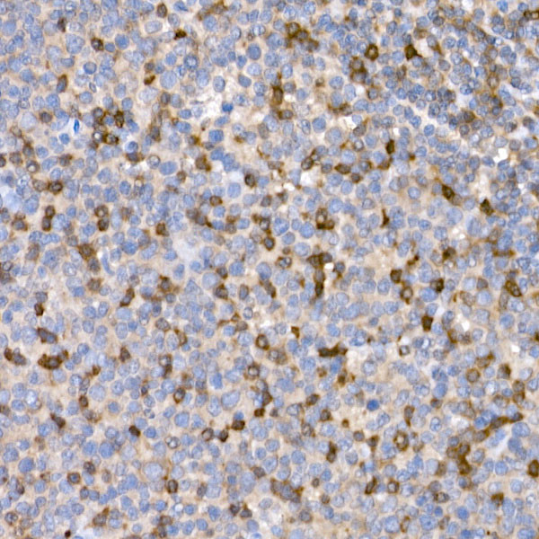 LTBR Antibody in Immunohistochemistry (Paraffin) (IHC (P))