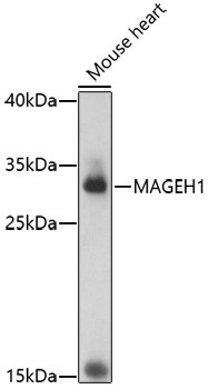 MAGEH1 Antibody in Western Blot (WB)