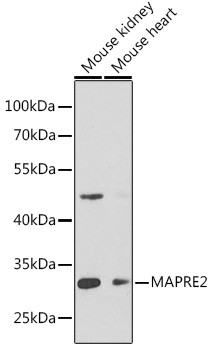 MAPRE2 Antibody in Western Blot (WB)