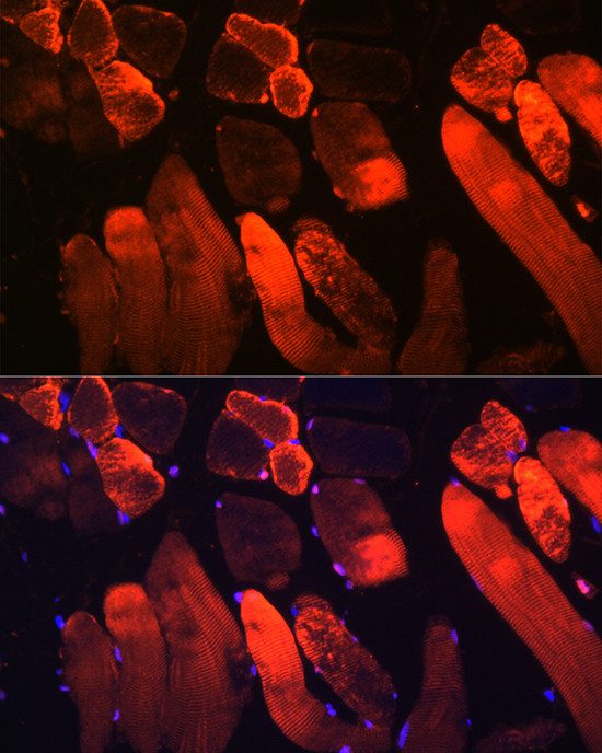 Myoglobin Antibody in Immunocytochemistry (ICC/IF)