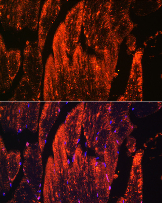 Myoglobin Antibody in Immunocytochemistry (ICC/IF)