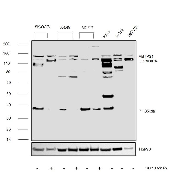 MBTPS1 Antibody in Western Blot (WB)