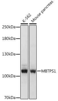 MBTPS1 Antibody in Western Blot (WB)