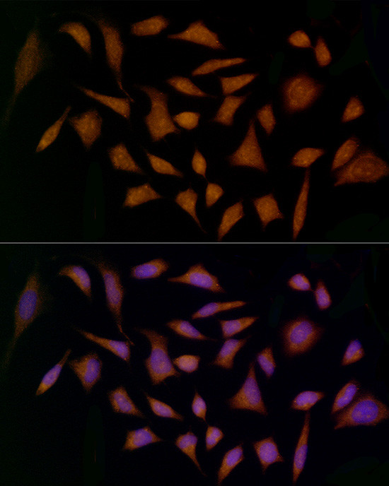 MDK Antibody in Immunocytochemistry (ICC/IF)