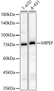 MIPEP Antibody in Western Blot (WB)