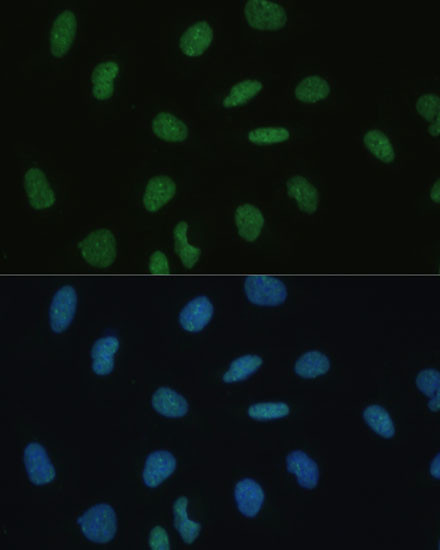 MKL1 Antibody in Immunocytochemistry (ICC/IF)