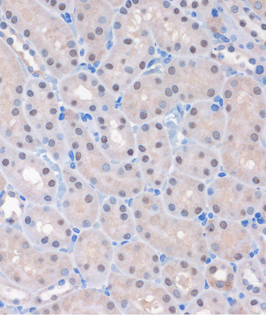 MTMR8 Antibody in Immunohistochemistry (Paraffin) (IHC (P))