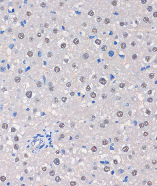 MTMR8 Antibody in Immunohistochemistry (Paraffin) (IHC (P))