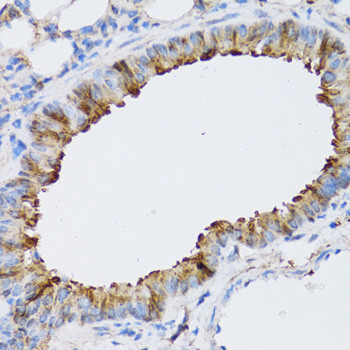 ARD1A Antibody in Immunohistochemistry (Paraffin) (IHC (P))