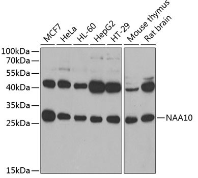 ARD1A Antibody in Western Blot (WB)