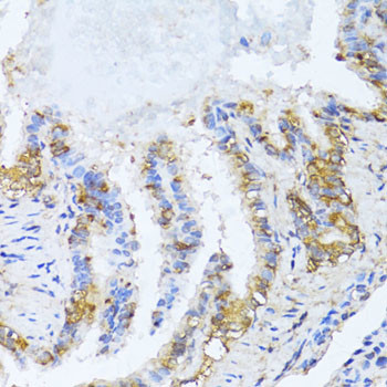 NAT2 Antibody in Immunohistochemistry (Paraffin) (IHC (P))