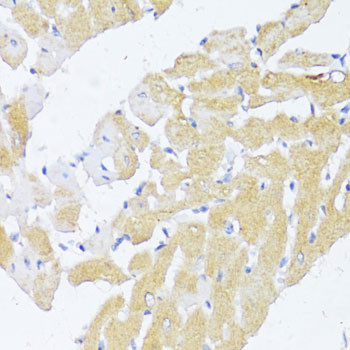 NAT2 Antibody in Immunohistochemistry (Paraffin) (IHC (P))