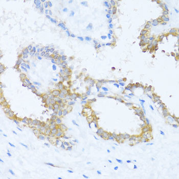 NAT2 Antibody in Immunohistochemistry (Paraffin) (IHC (P))