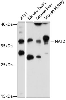 NAT2 Antibody in Western Blot (WB)