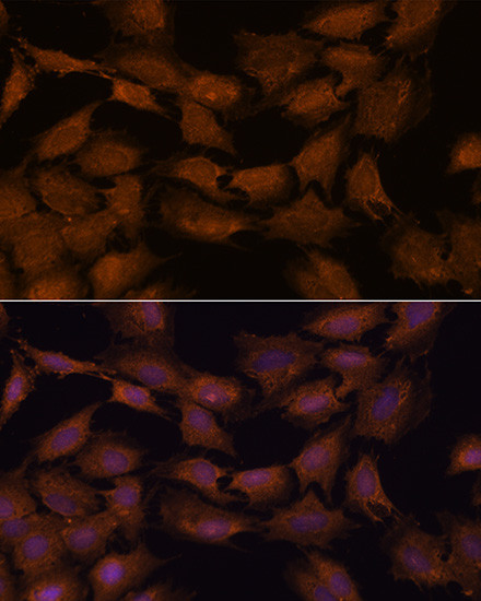 NCAPD2 Antibody in Immunocytochemistry (ICC/IF)