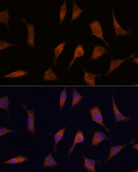 NCAPD2 Antibody in Immunocytochemistry (ICC/IF)