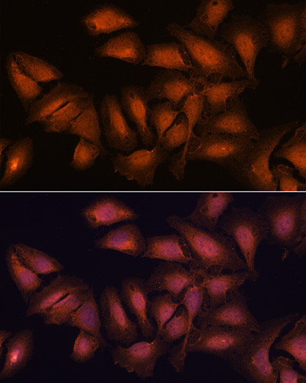 NCAPD2 Antibody in Immunocytochemistry (ICC/IF)