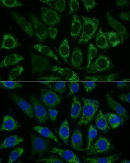 NDUFS8 Antibody in Immunocytochemistry (ICC/IF)