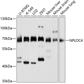 NPLOC4 Antibody in Western Blot (WB)