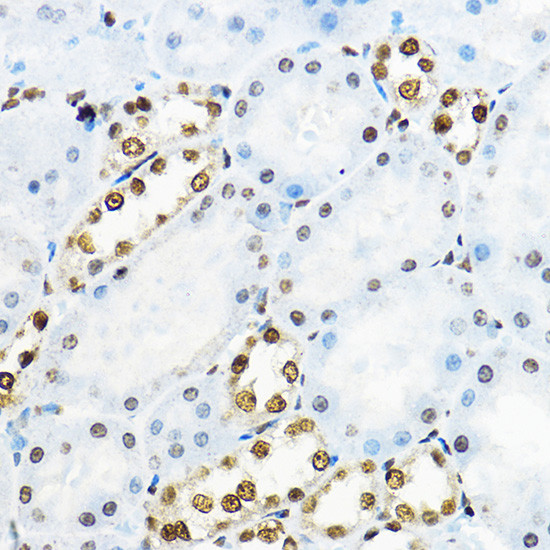 NR5A2 Antibody in Immunohistochemistry (Paraffin) (IHC (P))