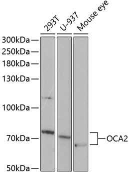 OCA2 Antibody in Western Blot (WB)