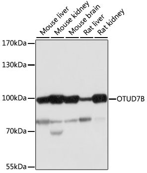 OTUD7B Antibody in Western Blot (WB)