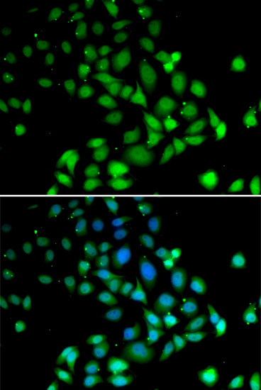 PARN Antibody in Immunocytochemistry (ICC/IF)