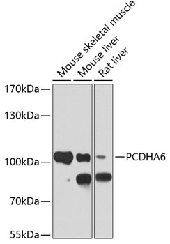 PCDHA6 Antibody in Western Blot (WB)