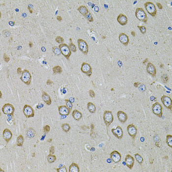 PDE1B Antibody in Immunohistochemistry (Paraffin) (IHC (P))