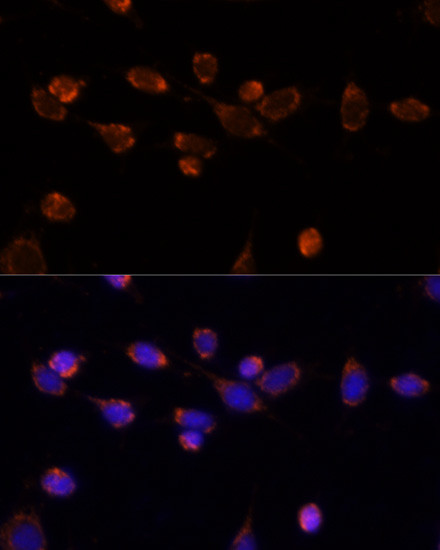 PDHA1 Antibody in Immunocytochemistry (ICC/IF)